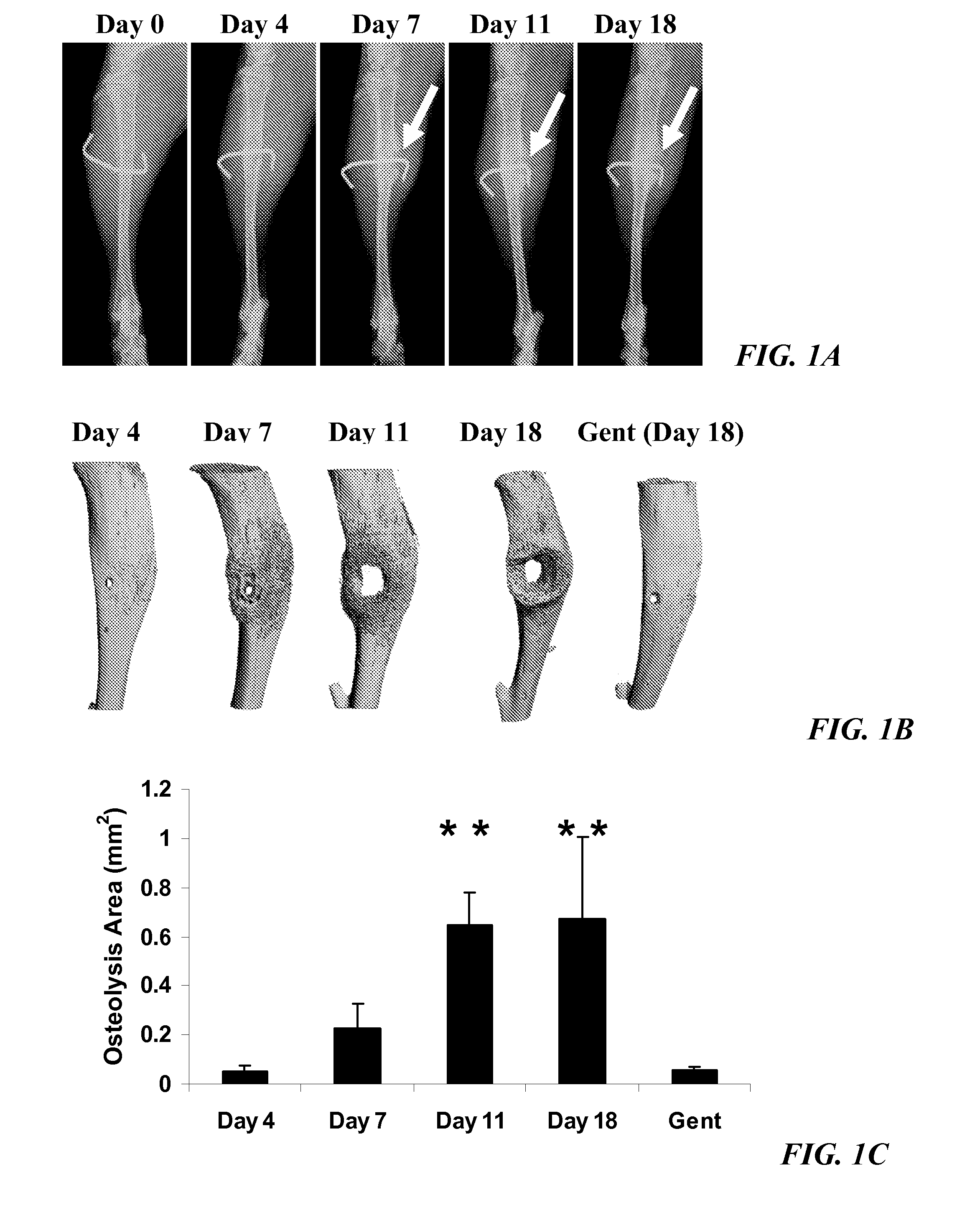 Anti-glucosaminidase passive immunization for staphylococcus aureus infections