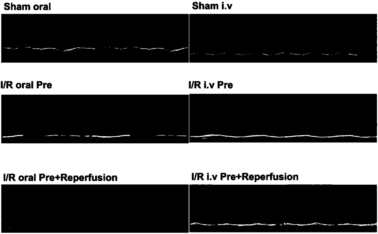 Injection agent for protecting ischemic myocardium and preparation method of injection