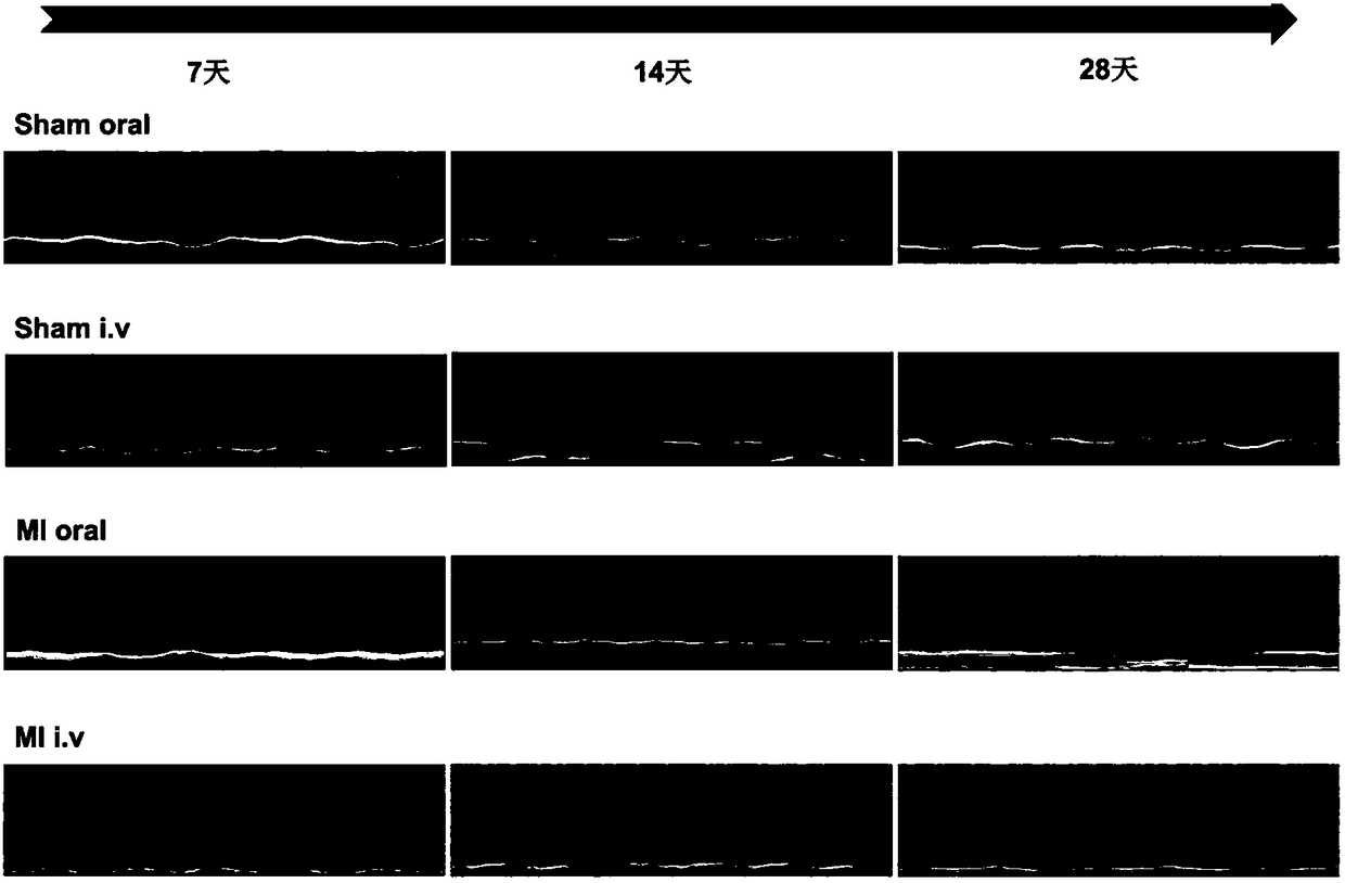 Injection agent for protecting ischemic myocardium and preparation method of injection