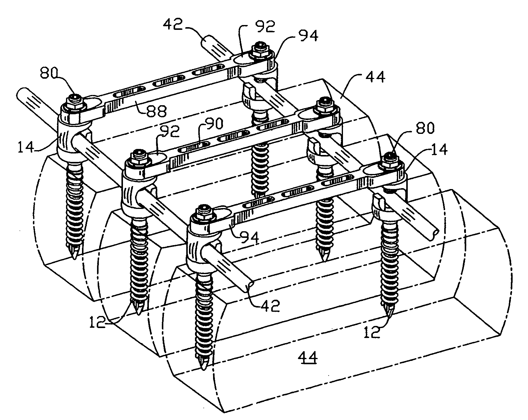 Apparatus ans method for aligning and/or stabilizing the spine