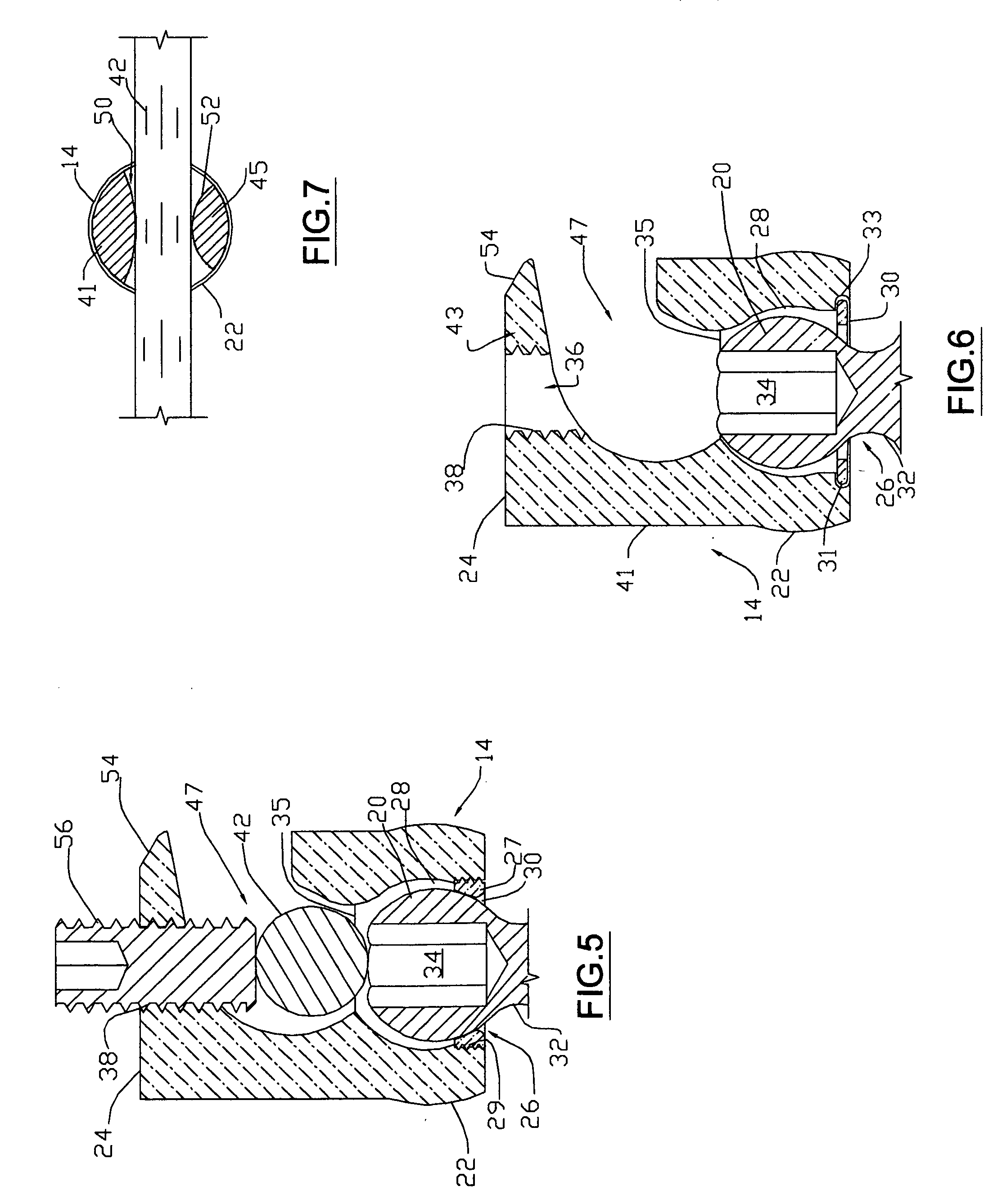 Apparatus ans method for aligning and/or stabilizing the spine