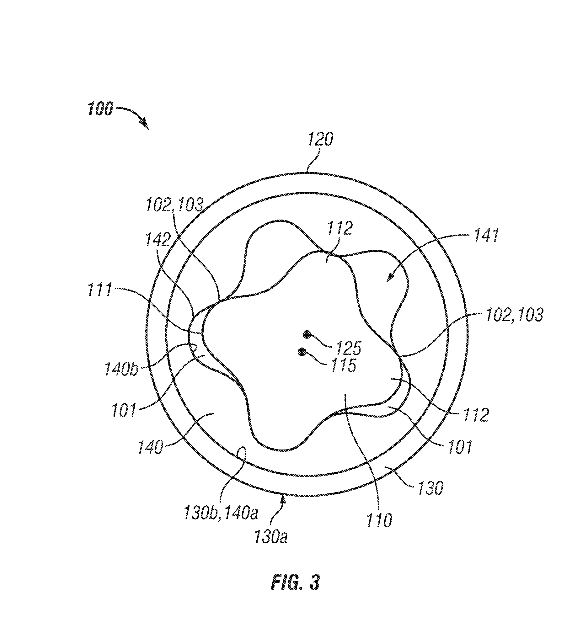 Reinforced Stators and Fabrication Methods