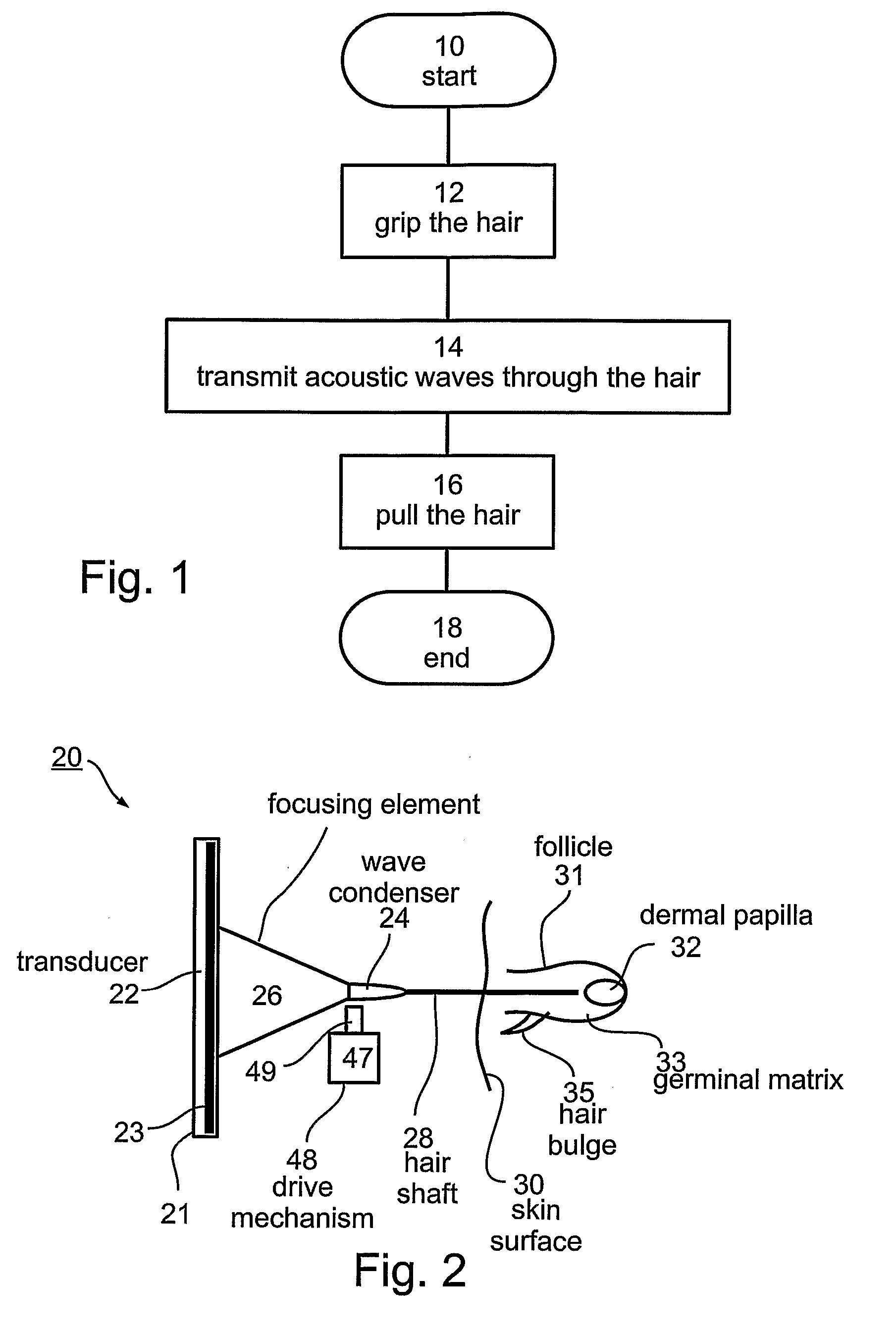 Method and device for removing hair