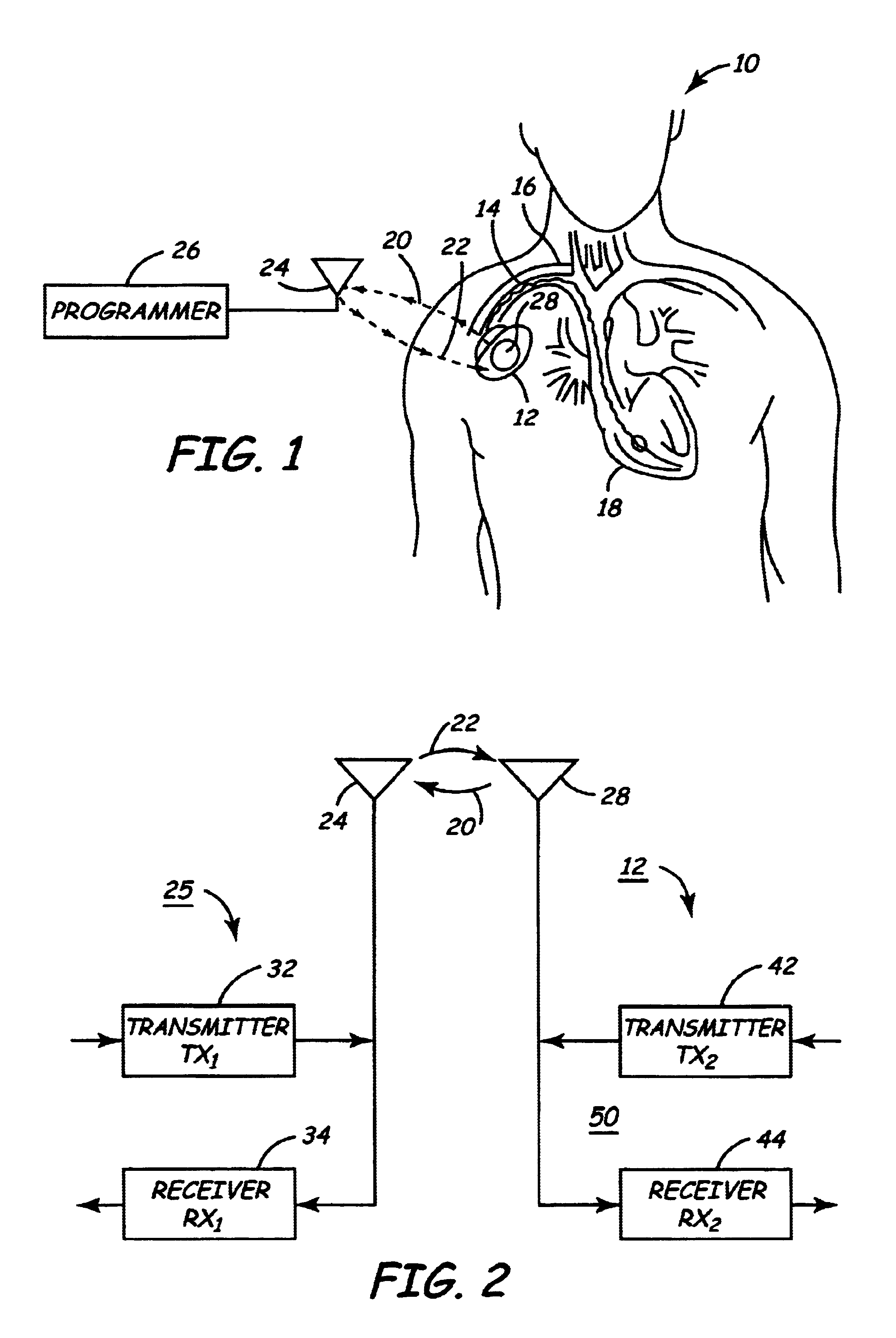 System and method for determining remaining battery life for an implantable medical device