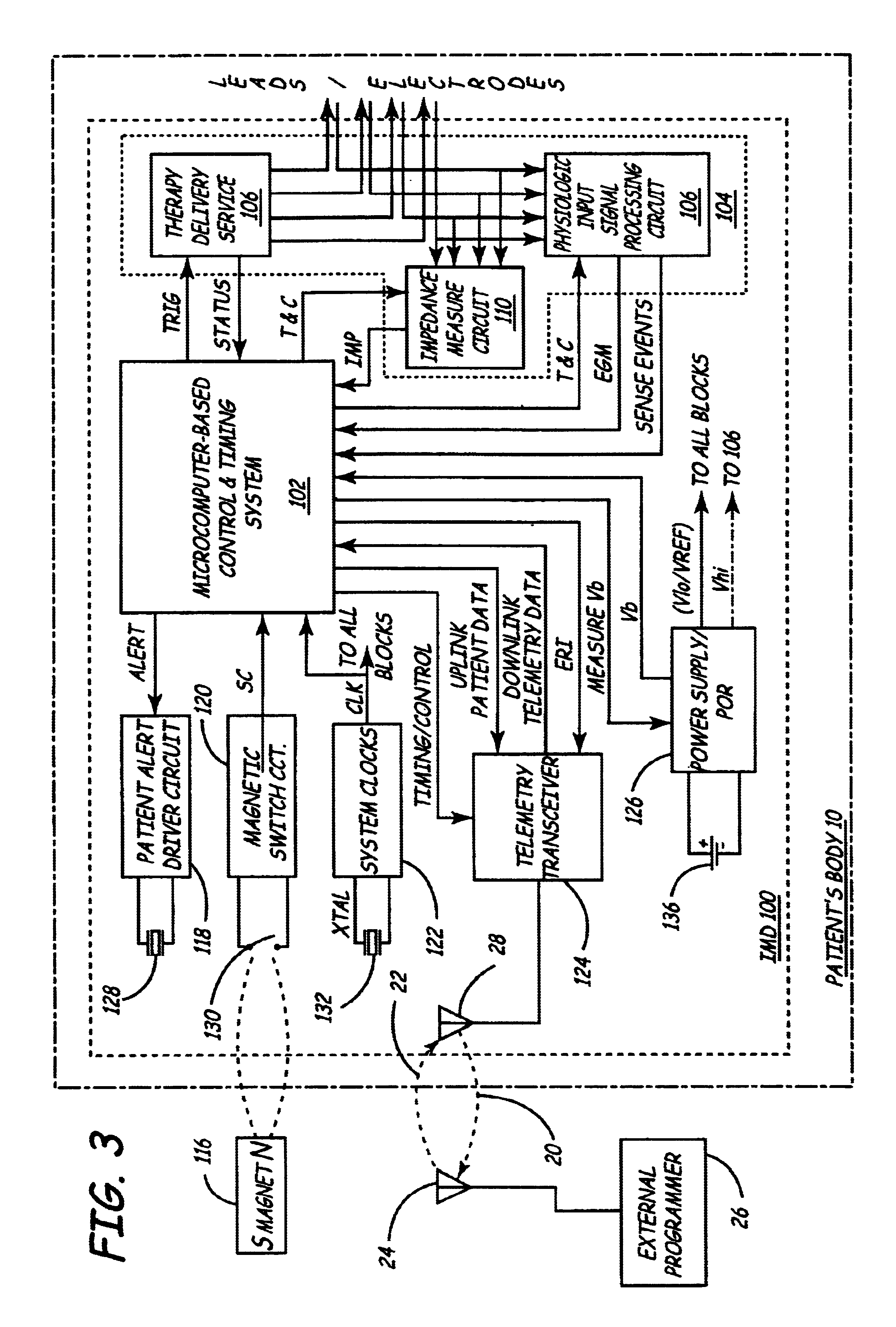 System and method for determining remaining battery life for an implantable medical device