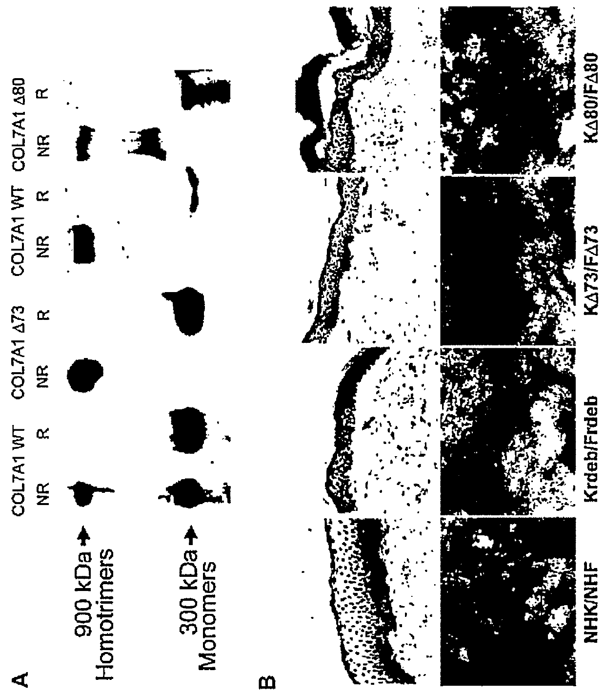 Exon skipping therapy for dystrophic epidermolysis bullosa