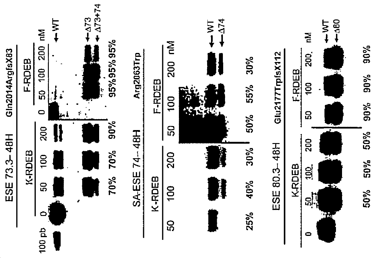 Exon skipping therapy for dystrophic epidermolysis bullosa