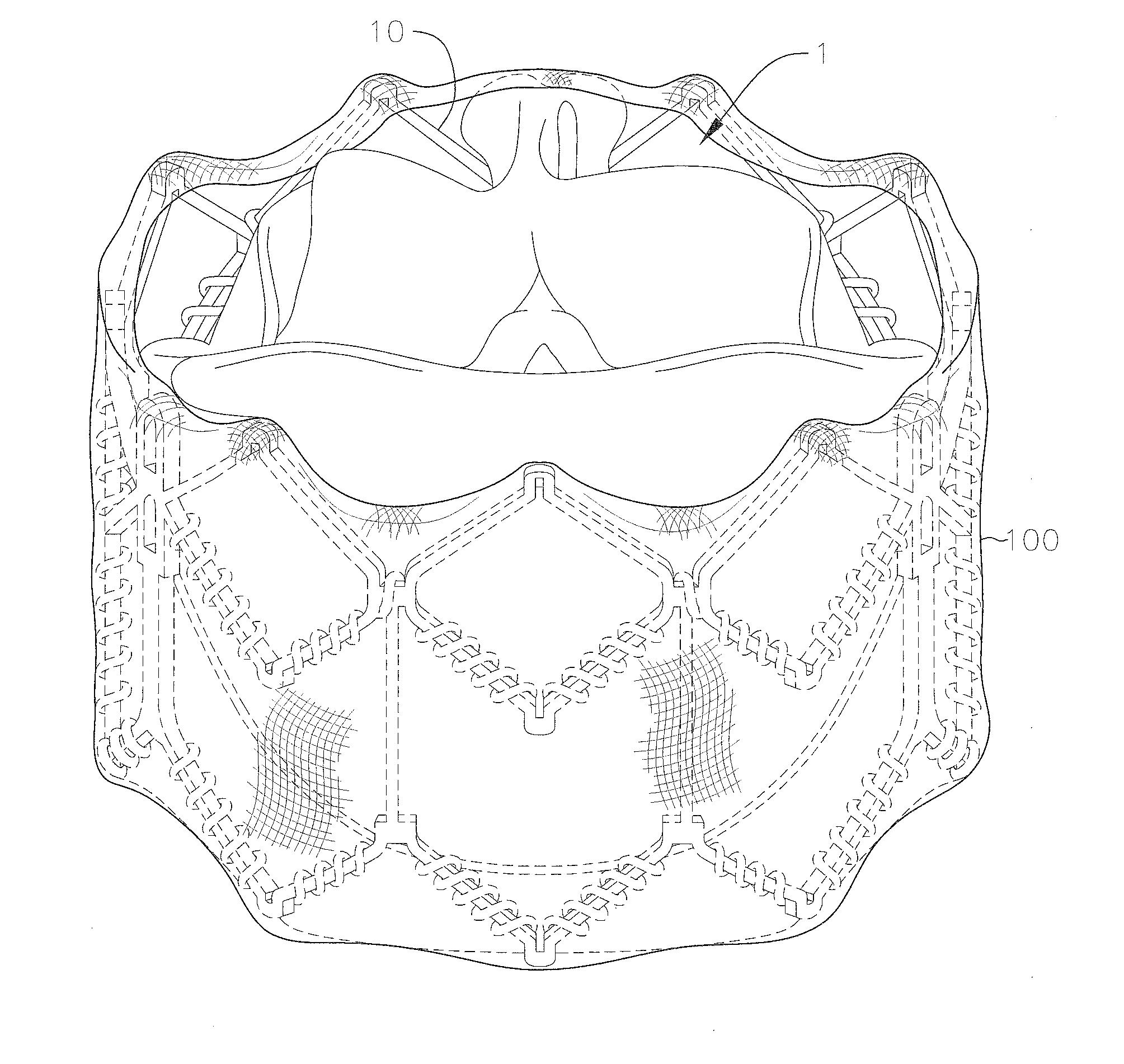 Covering and assembly method for transcatheter valve