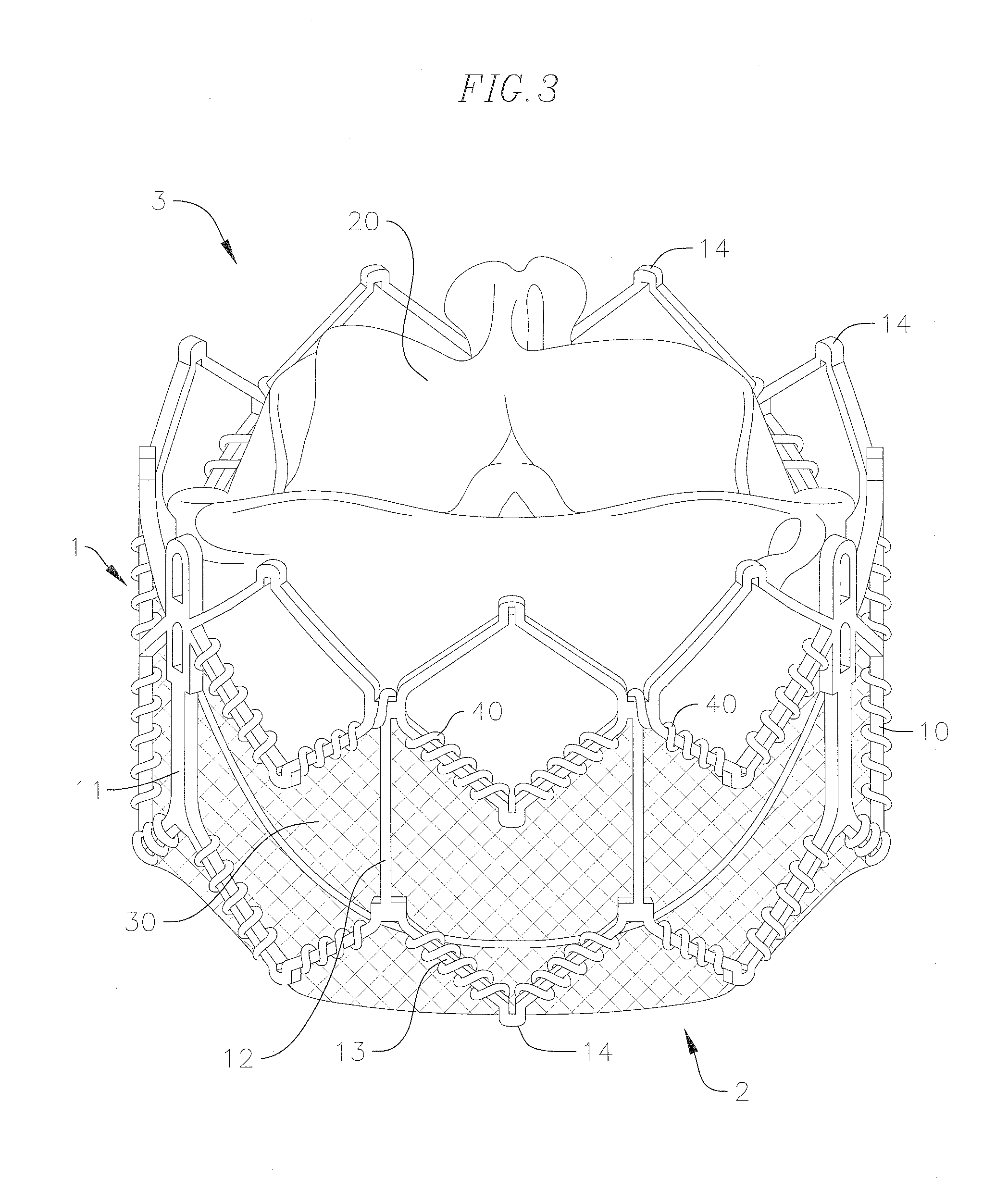 Covering and assembly method for transcatheter valve