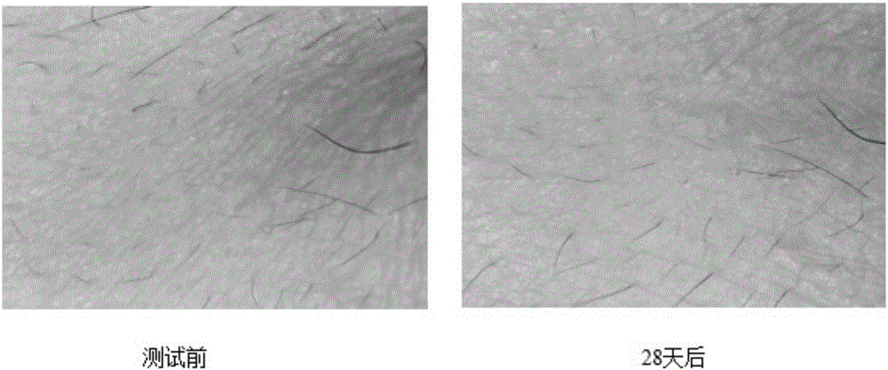 Anti-ageing composition comprising myrothamnus flabellifolia extract and preparation method thereof