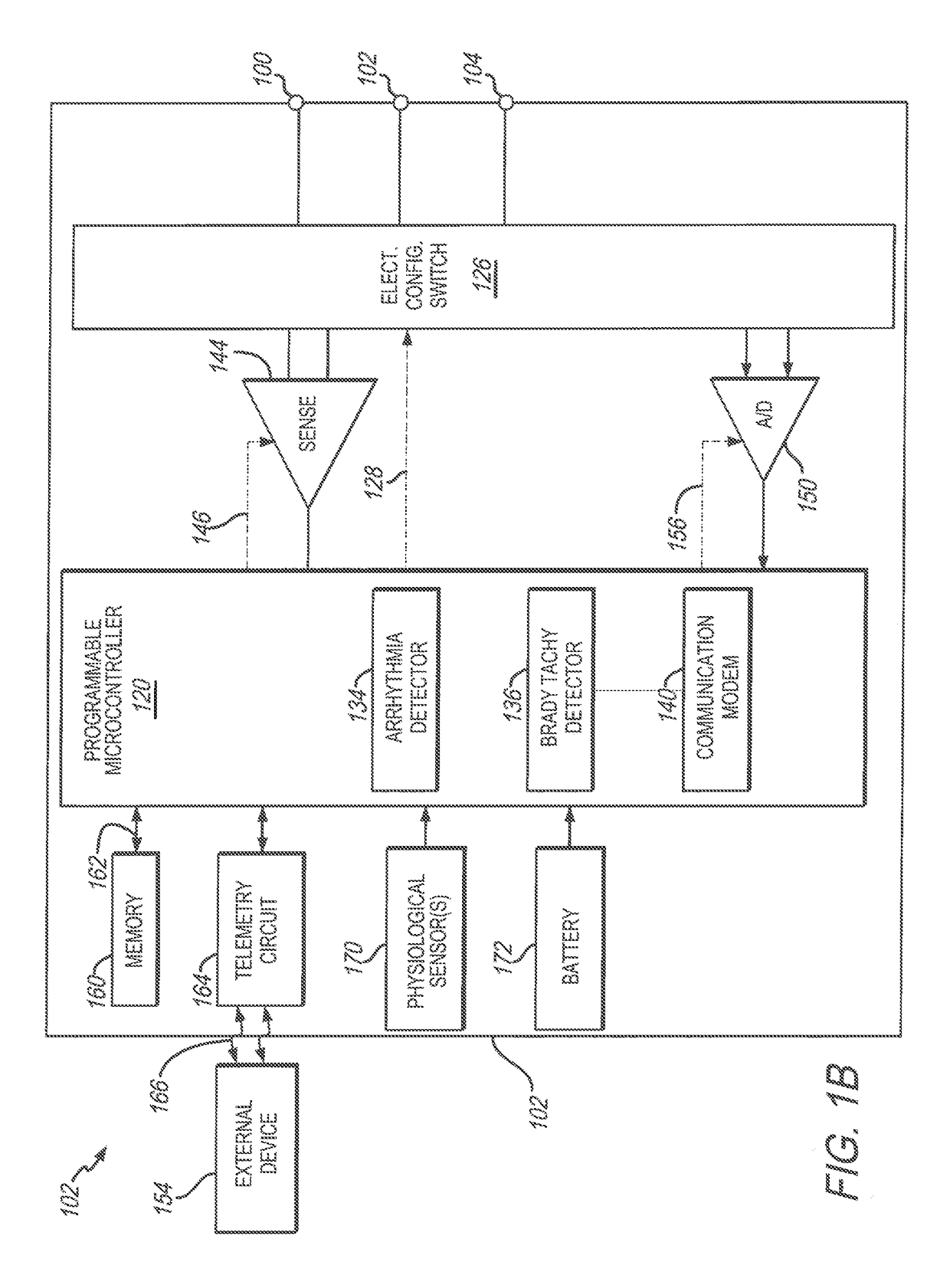 Method and system to discriminate rhythm patterns in cardiac activity