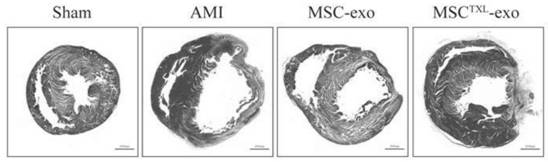 Mesenchymal stem cell source exosome based on Tongxinluo pretreatment and preparation method thereof