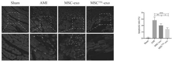 Mesenchymal stem cell source exosome based on Tongxinluo pretreatment and preparation method thereof