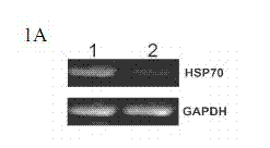 Method for regulating expression, quantity and activity of heat shock protein 70 and application thereof