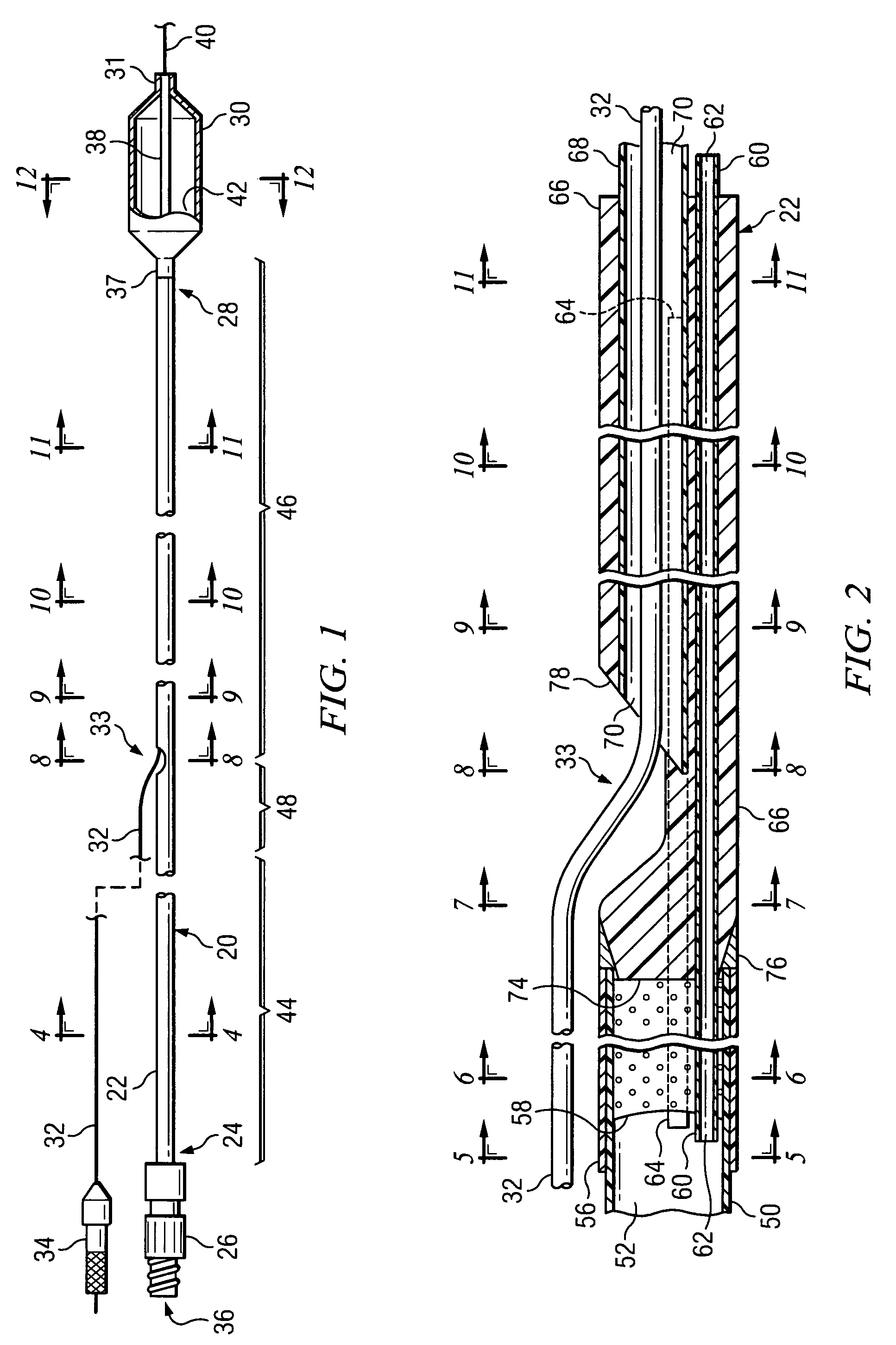 Rapid exchange balloon dilation catheter having reinforced multi-lumen distal portion