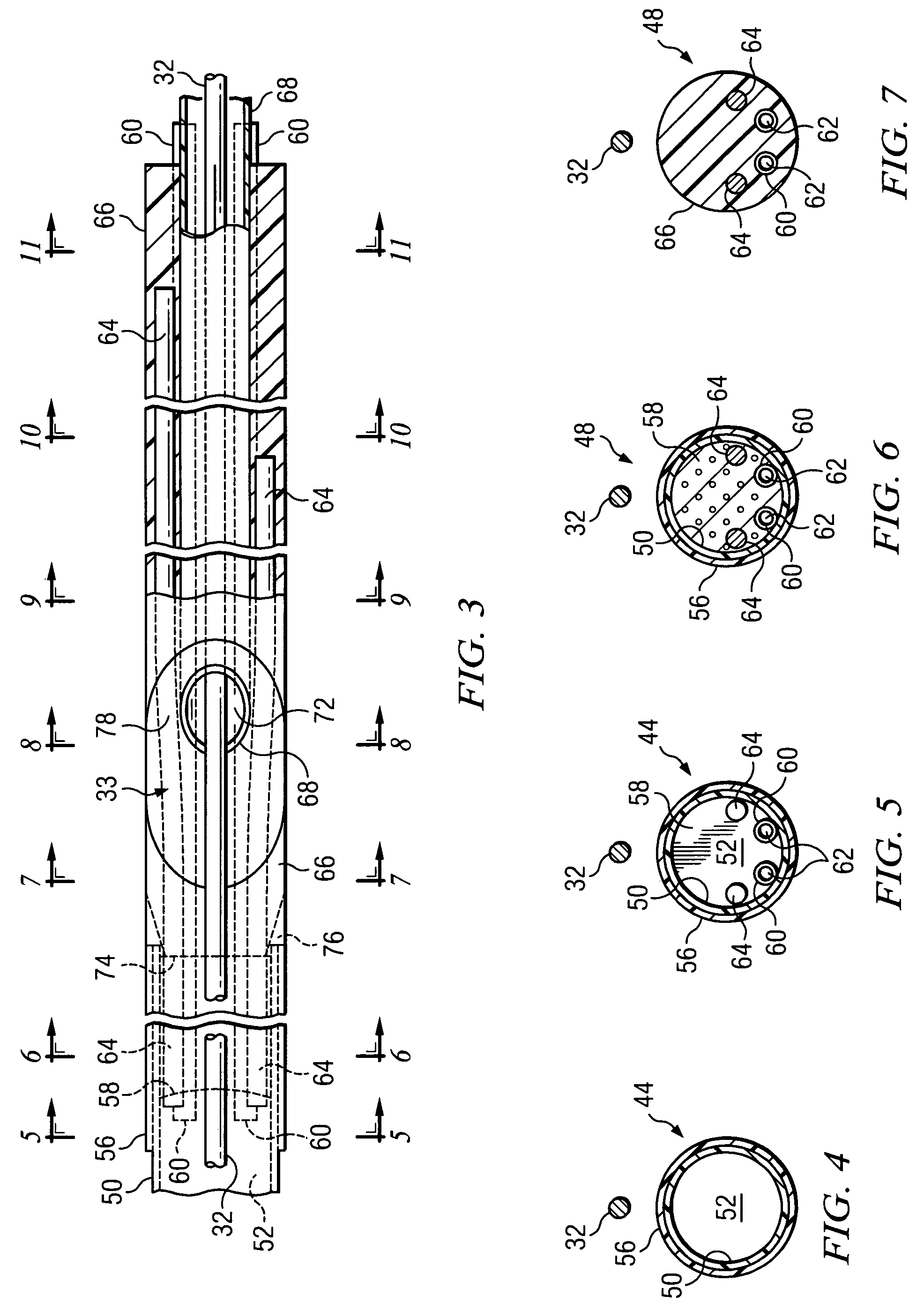 Rapid exchange balloon dilation catheter having reinforced multi-lumen distal portion