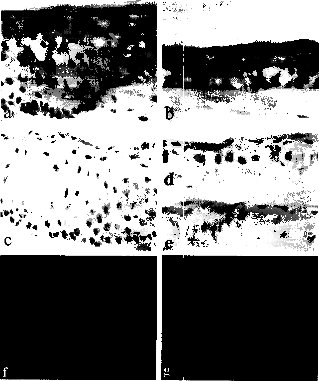 Cornea edge stem cell tissue engineering composite body and its preparation method