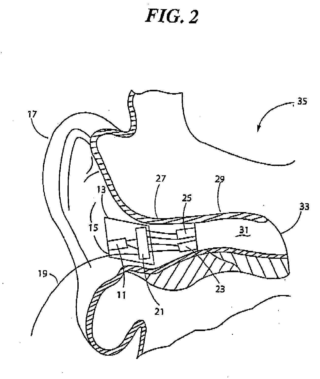 Earguard monitoring system