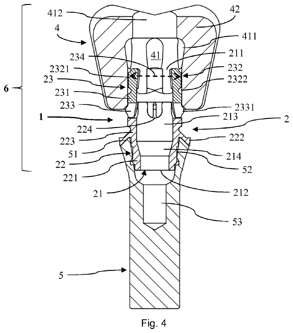 System for connecting a dental restoration to a dental implant