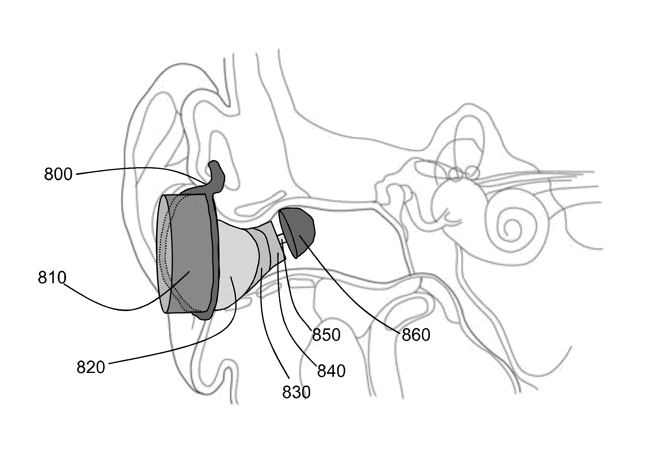 Earpiece sealing system