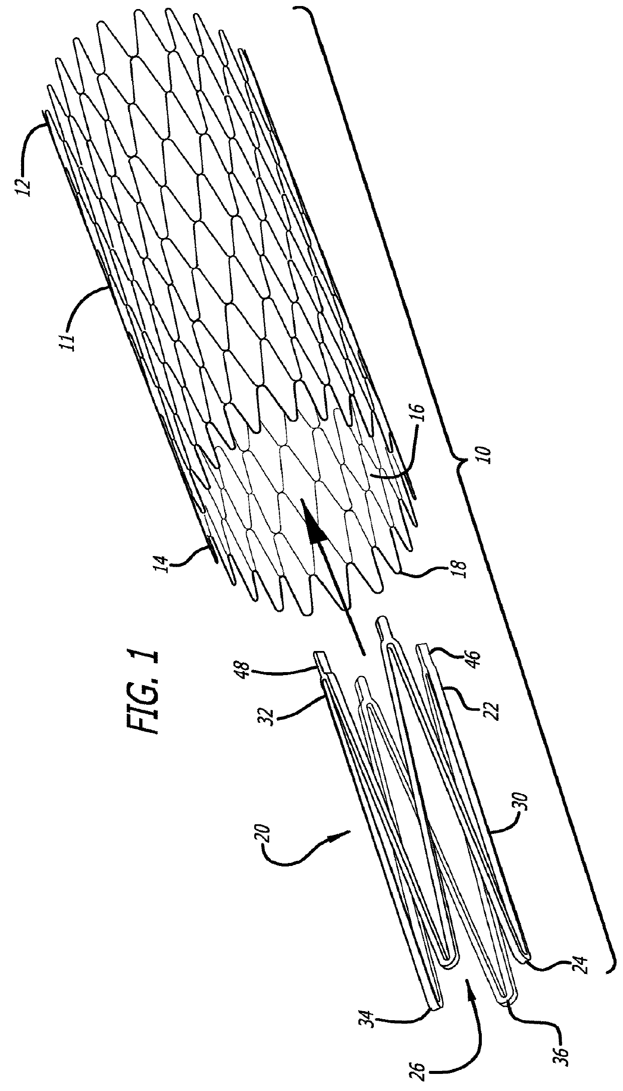 Braided stent with expansion ring and method of delivery