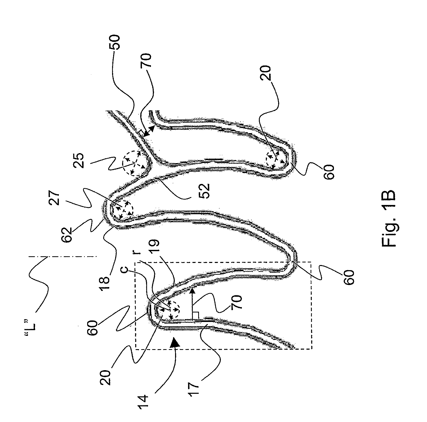 Flexible extendable stent and methods of surface modification therefor