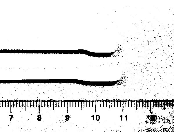 Degradable high polymer reticular balloon for vertebral fracture treatment and preparation method of balloon