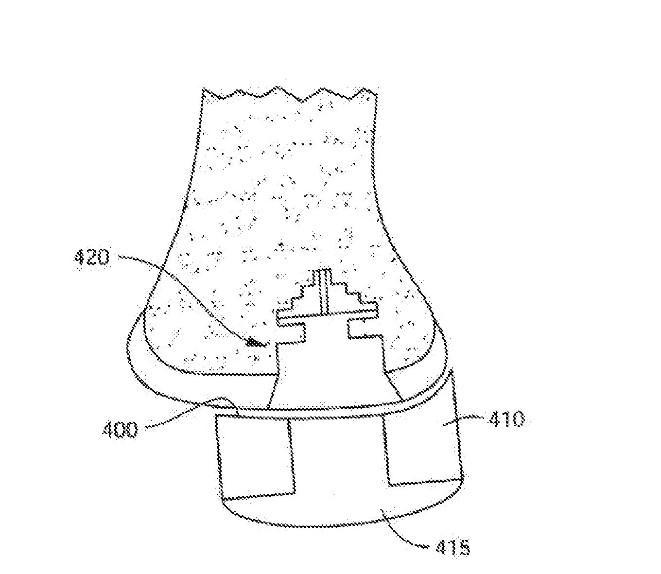 Patient Selectable Joint Arthroplasty Devices and Surgical Tools Incorporating Anatomical Relief