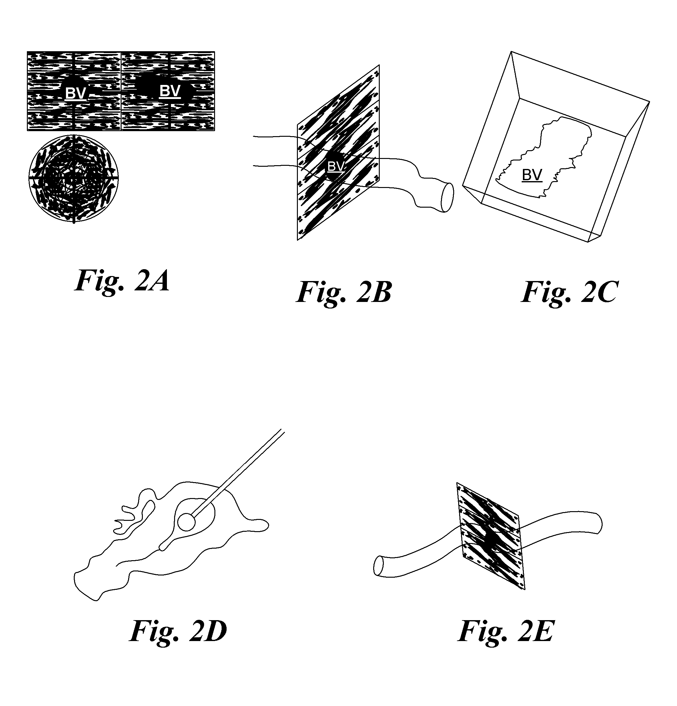 Blood vessel access devices, systems, and methods