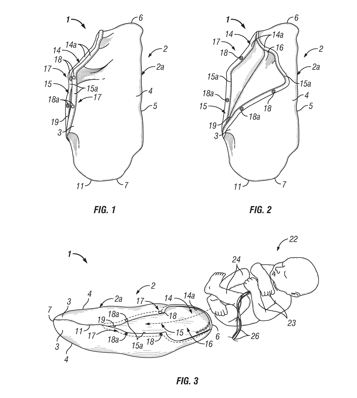 Infant joint compression device and method