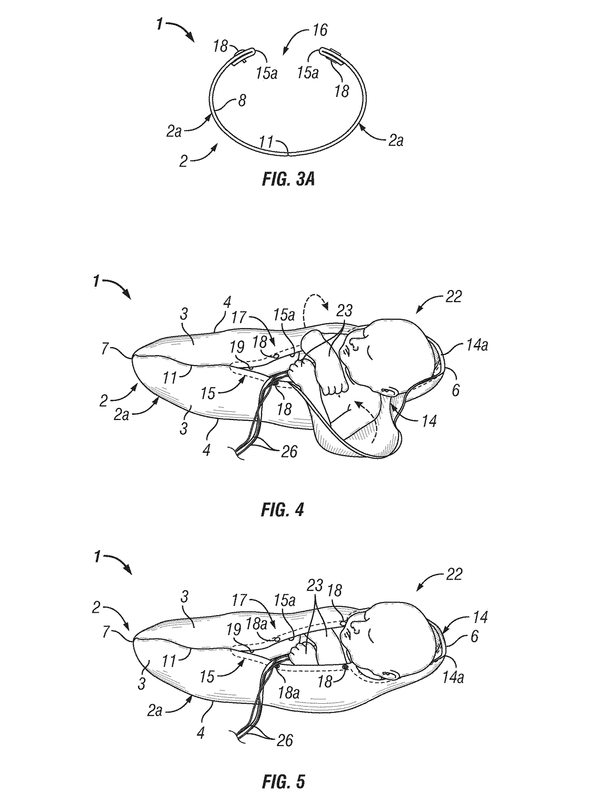 Infant joint compression device and method