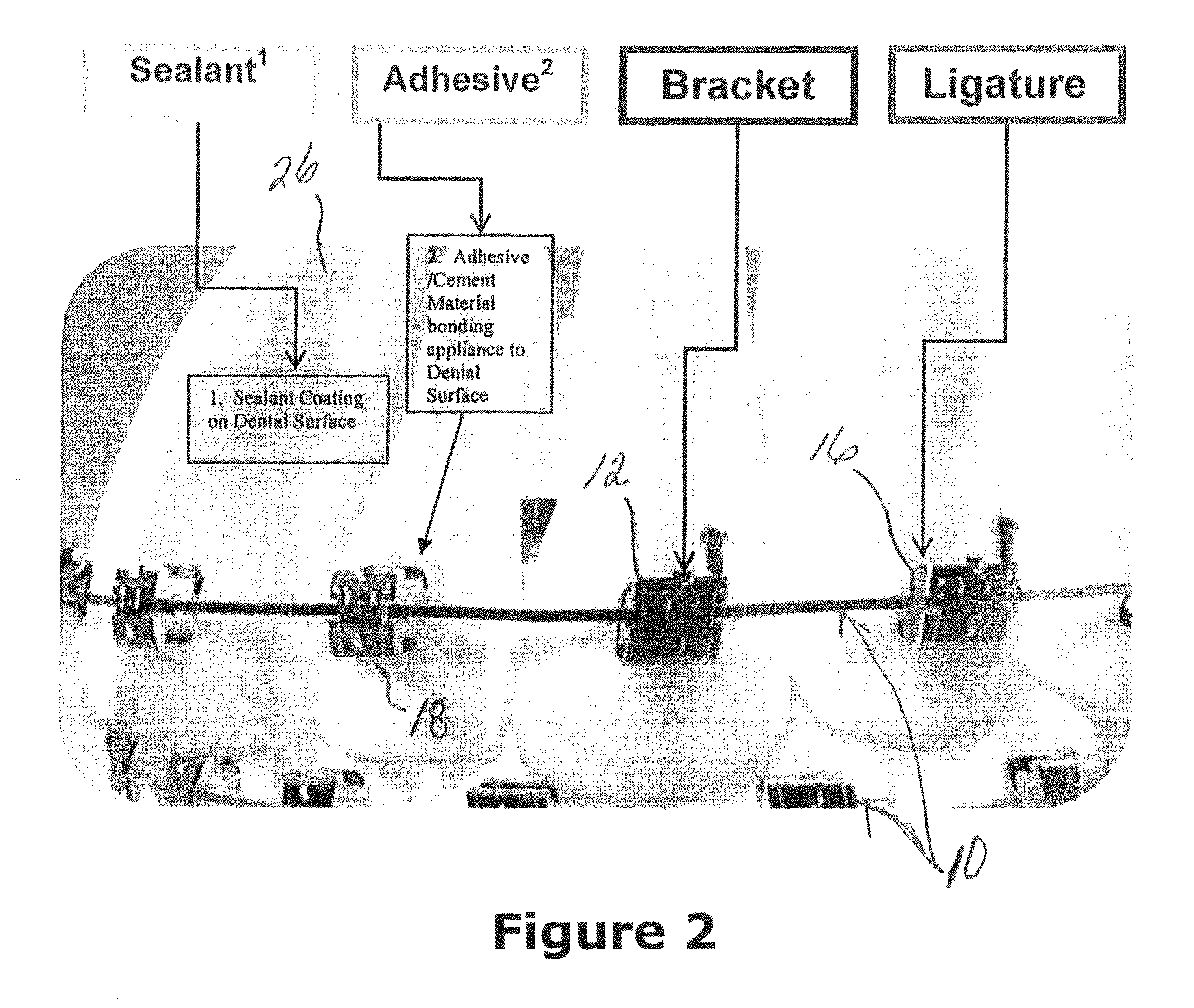 Anti-microbial orthodontic compositions and appliances and methods of production and use thereof