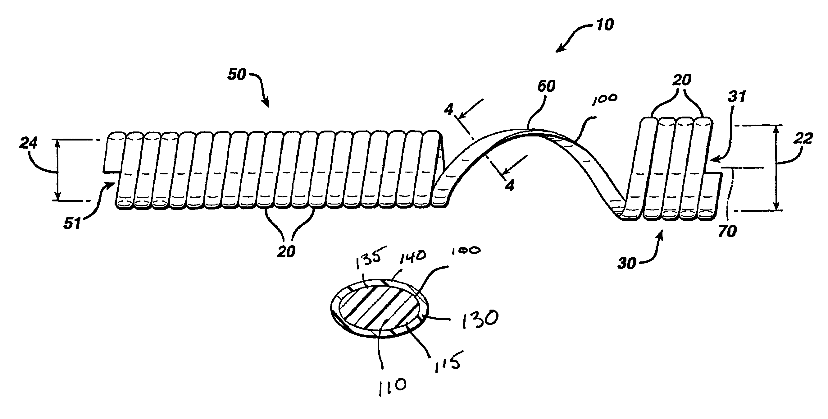 Biodegradable stent