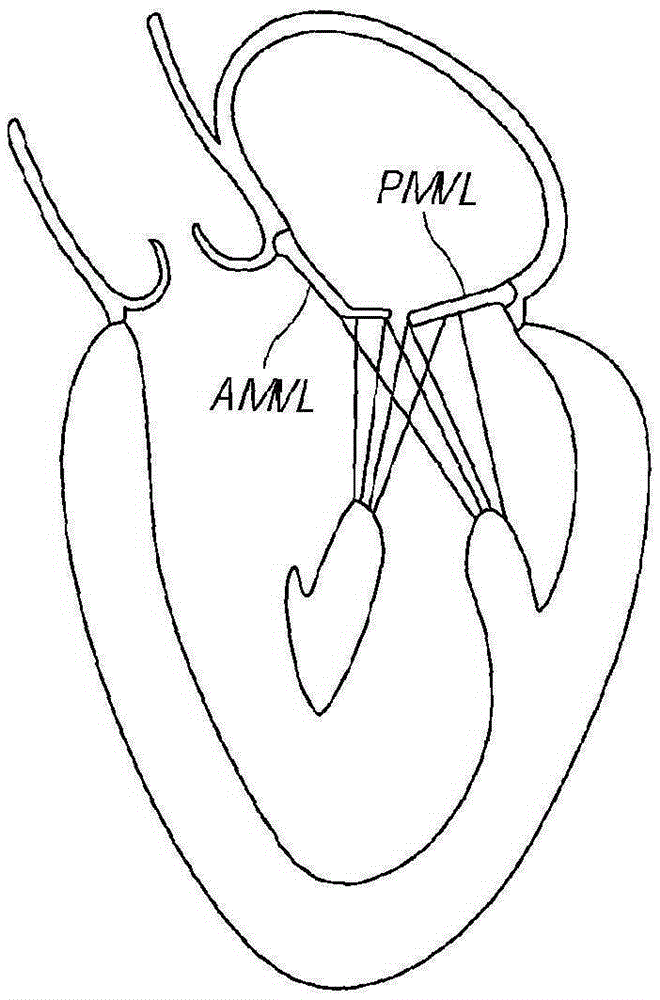 Implantable heart valve devices, mitral valve repair devices and associated systems and methods