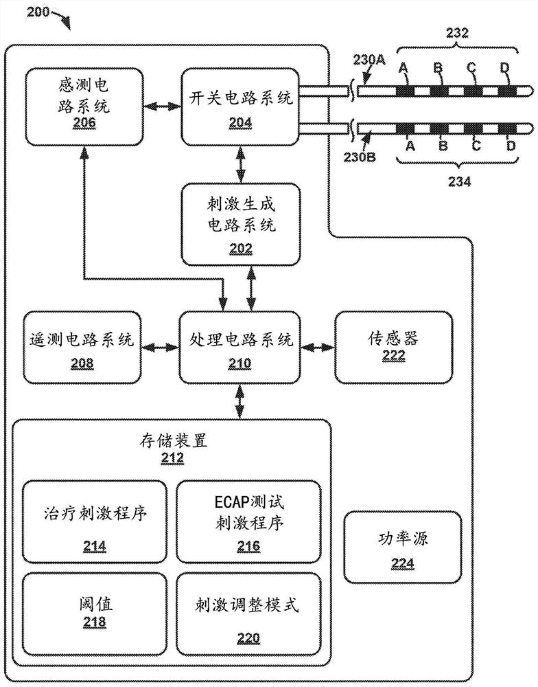 ECAP-based transient overstimulation