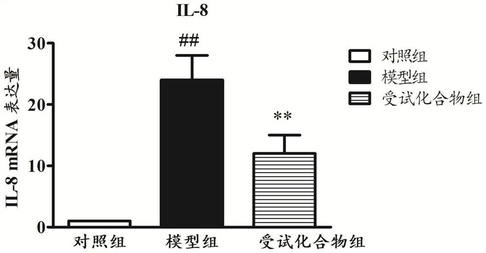 Application of compound in preparation of antiviral drug and application