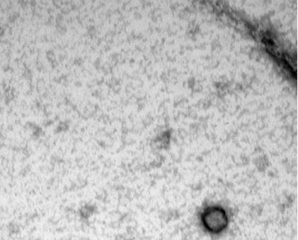 Recombinant PRRSV virus-like particles having immunogenicity and preparation thereof