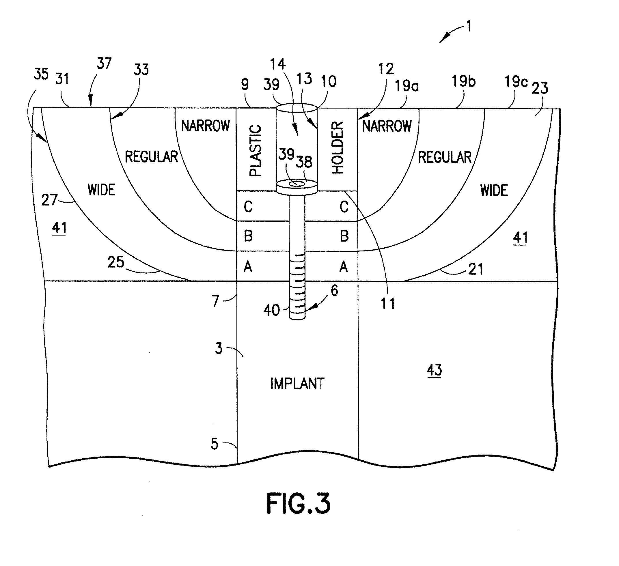 System and method for fabricating a dental healing abutment