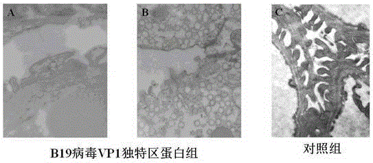 The application of b19 virus vp1 unique region protein to construct viral nephropathy model