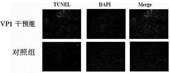 The application of b19 virus vp1 unique region protein to construct viral nephropathy model