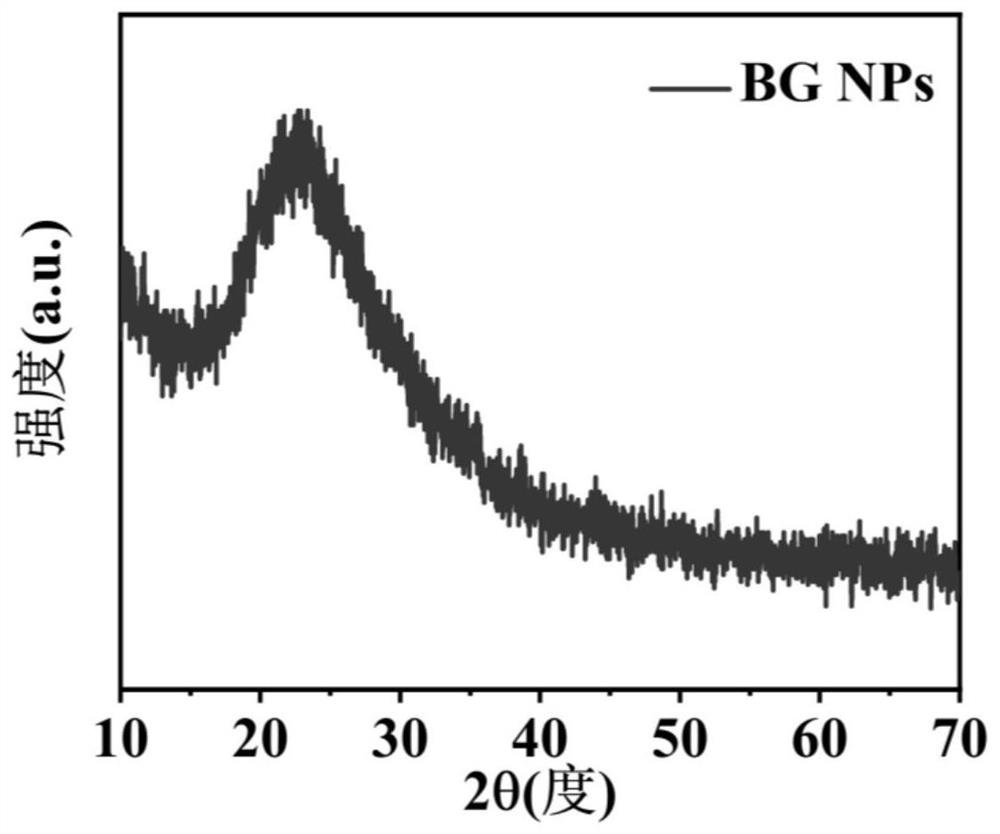 Novel injectable hydrogel for bone defect repair and preparation method thereof