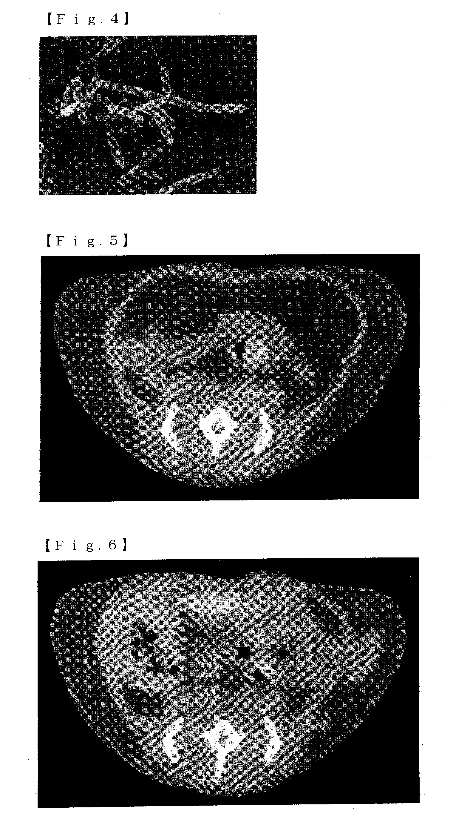 Mixture, dissolving solution and pharmaceutical agent each comprising thermophilic microorganism