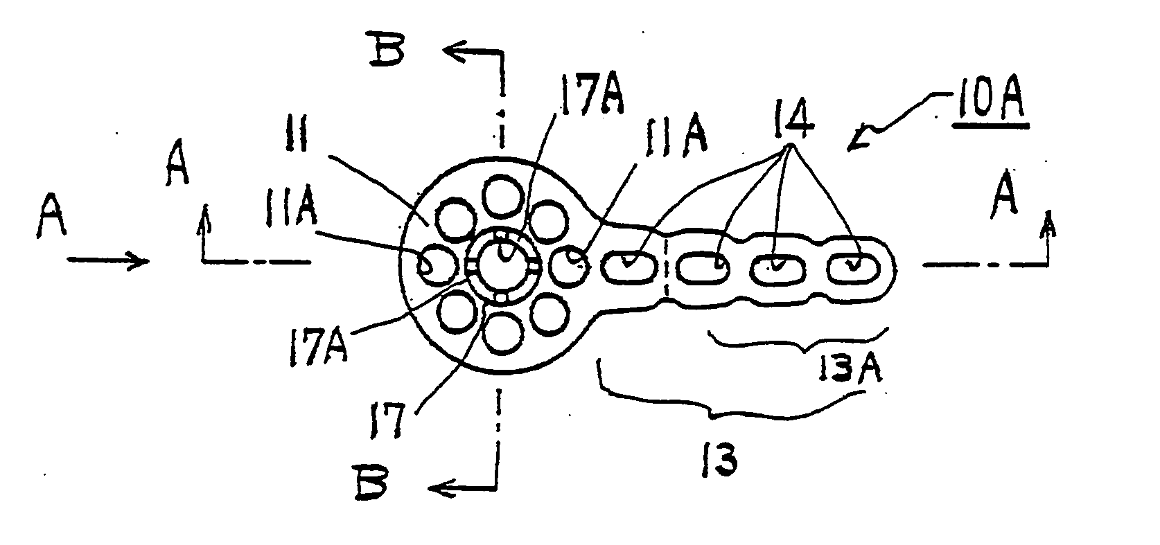 Orthodontic anchor