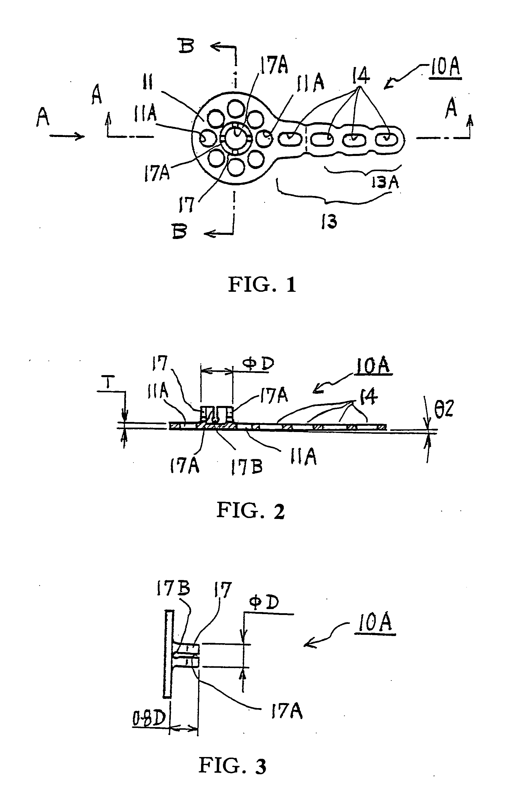 Orthodontic anchor