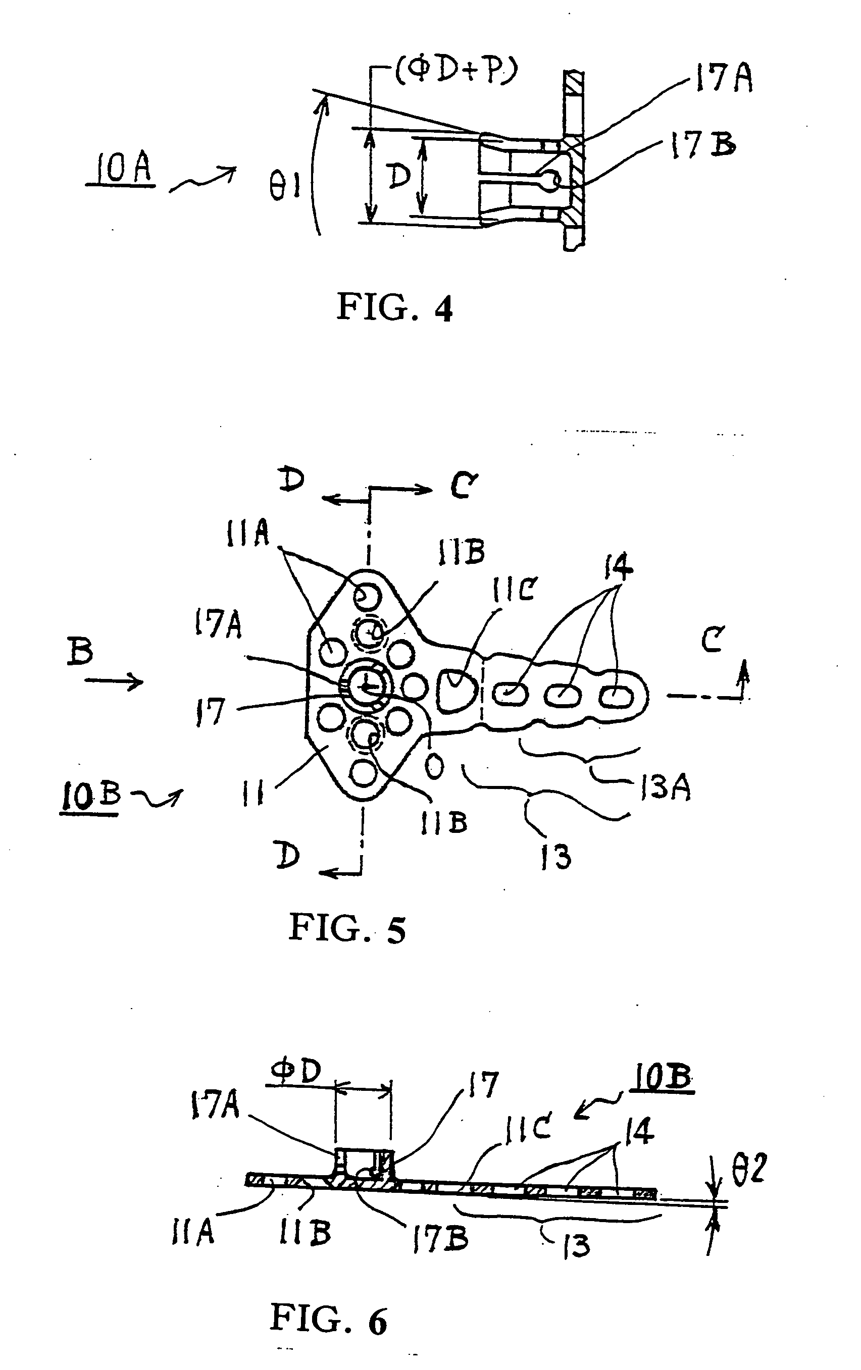 Orthodontic anchor