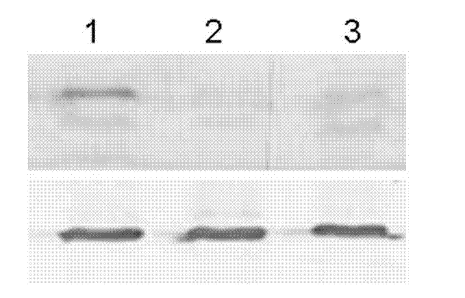 Bispecific antibody of resisting PSMA/FITC (prostate specific membrane antigen/fluorescein isothiocyanate) for early diagnosis and treatment of prostatic cancer and preparation method of bispecific antibody