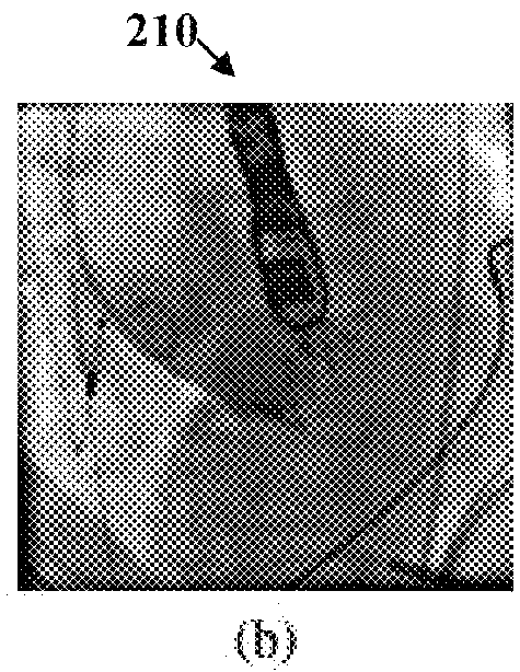 Method and system for pericardium based model fusion of pre-operative and intra-operative image data for cardiac interventions