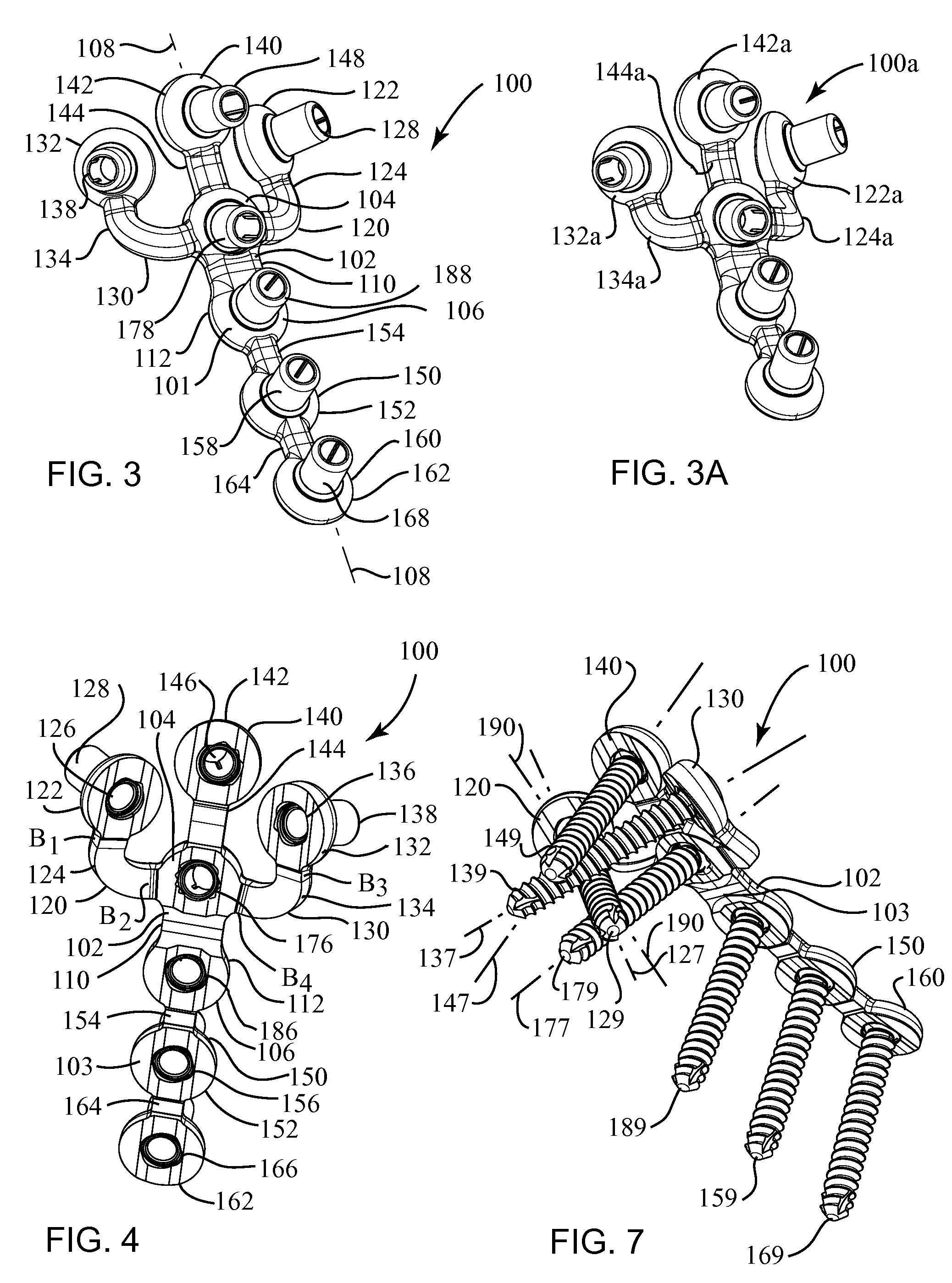 Fracture fixation plate for the olecranon of the proximal ulna