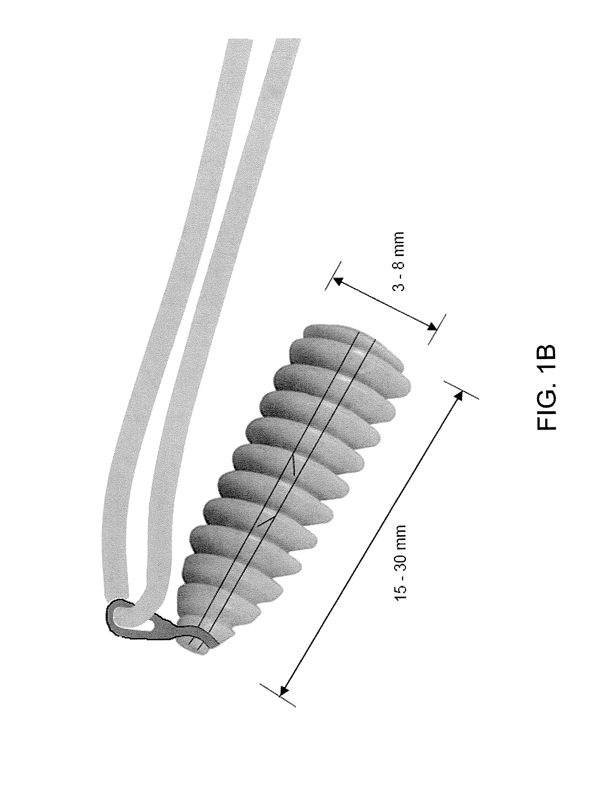 Implant and method for repair of the anterior cruciate ligament