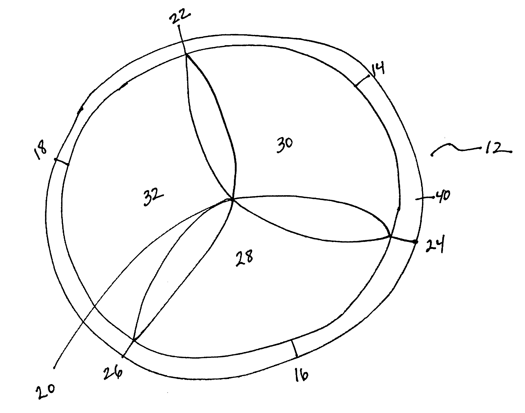 Sewing Ring for a Prosthetic Tissue Valve